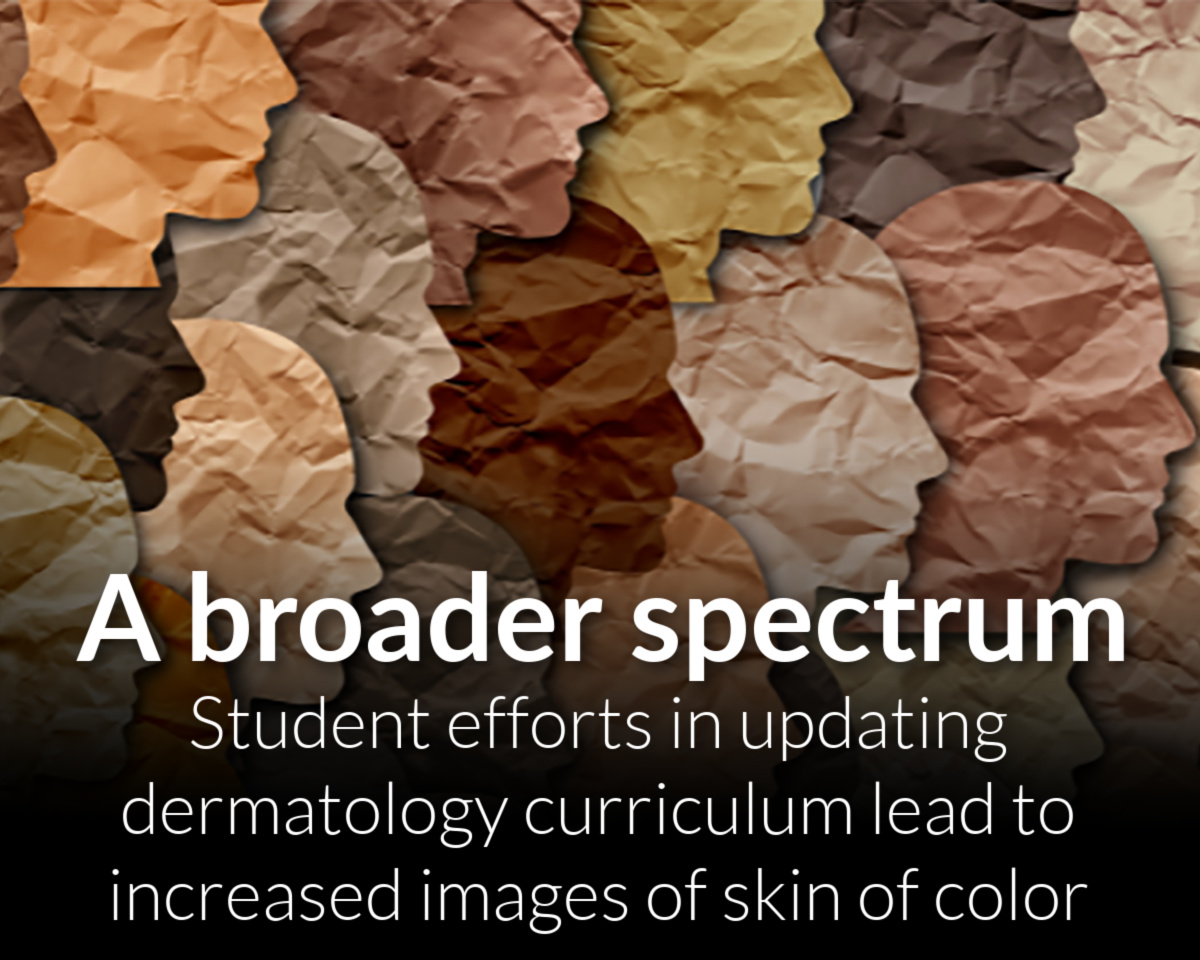 Student efforts in updating dermatology curriculum lead to increased images of skin of color