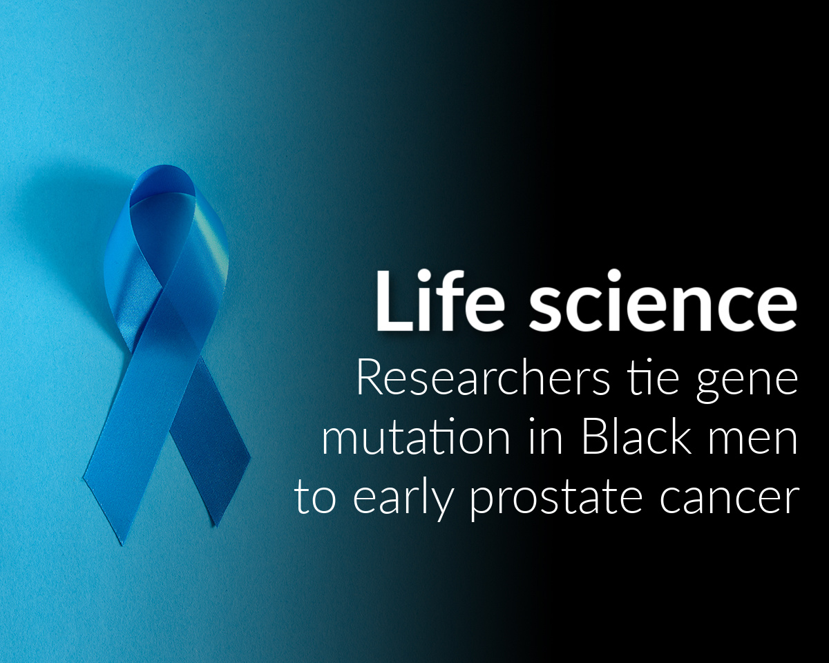 Researchers identify gene mutation in Black men that causes early prostate cancer