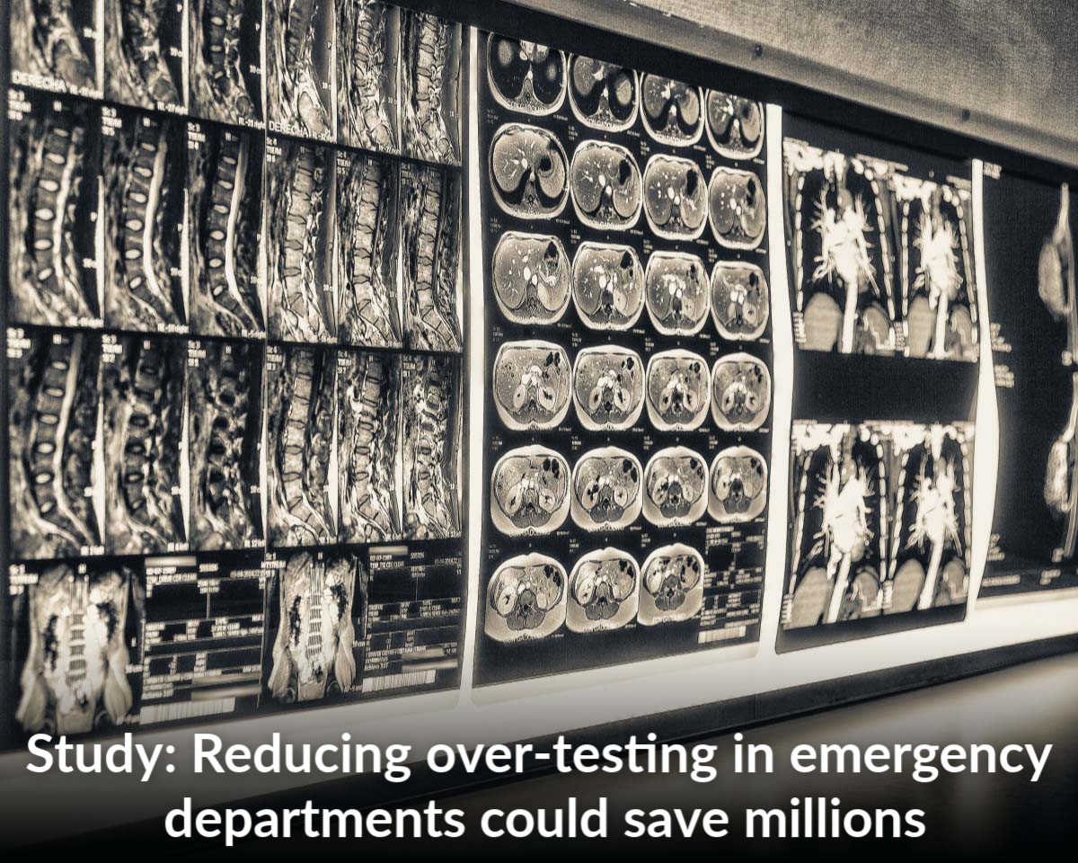 Study finds reducing over-testing in emergency departments could save millions